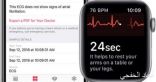 تحديث OS 5.1.2 لساعة أبل الذكية يوفر ميزة لرصد معدل ضربات القلب